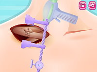 Emergency Surgery